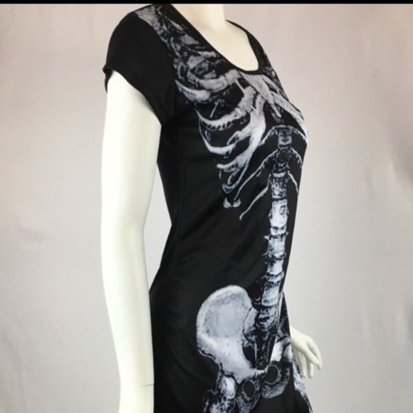 💀🖤Skeleton Dress🖤💀 - Picture 2 of 9
